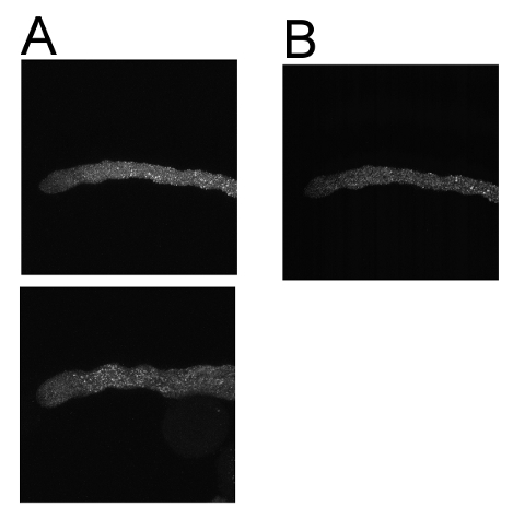 VDAC1 confocal image